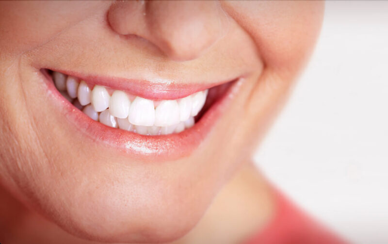 Teeth Whitening Brooklyn, NY Onatsky Dental Clinic